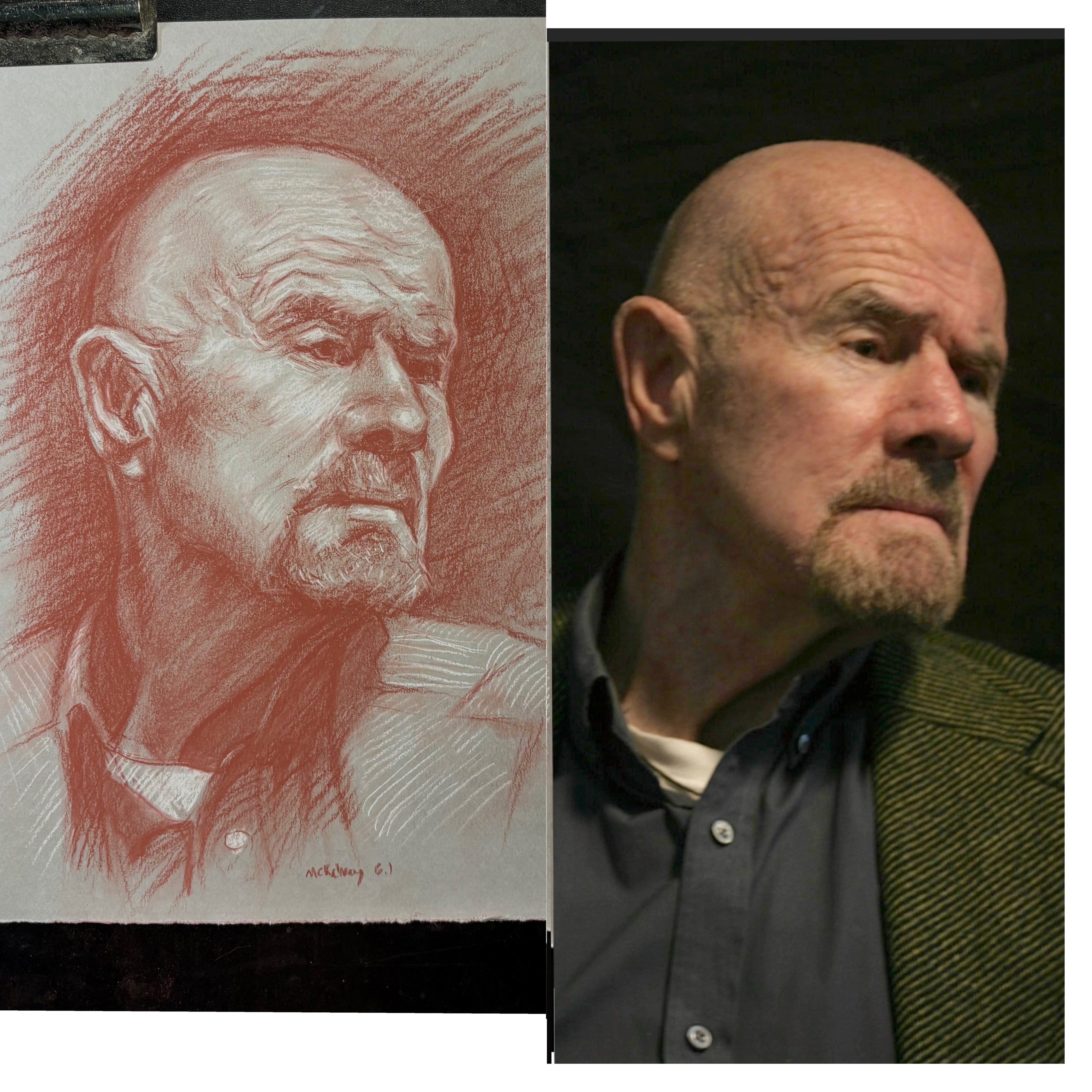 Bald Man Study